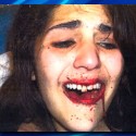 VIDEO: Civil lawsuit filed against the city alleging excessive force